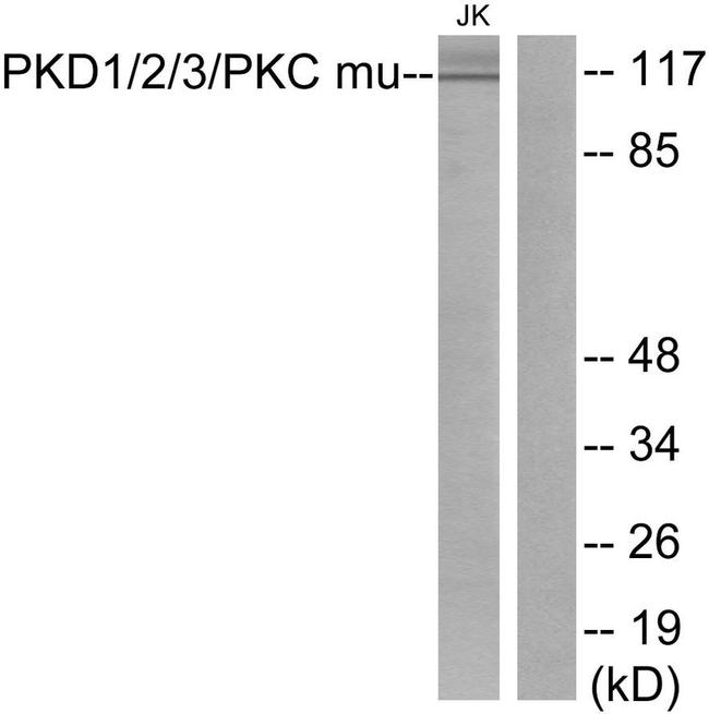 PKD1/2/3/PKC mu Antibody in Western Blot (WB)
