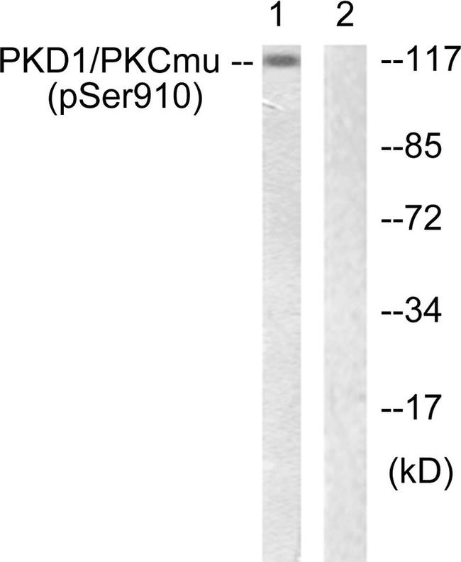 Phospho-PKC mu (Ser910) Antibody in Western Blot (WB)