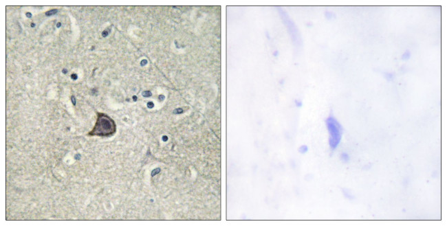 Phospho-PLCB3 (Ser537) Antibody in Immunohistochemistry (Paraffin) (IHC (P))