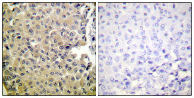 Phospho-PP1 alpha (Thr320) Antibody in Immunohistochemistry (Paraffin) (IHC (P))