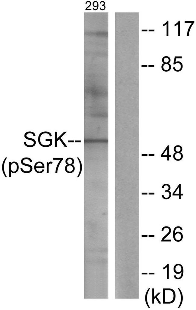 Phospho-SGK1 (Ser78) Antibody in Western Blot (WB)