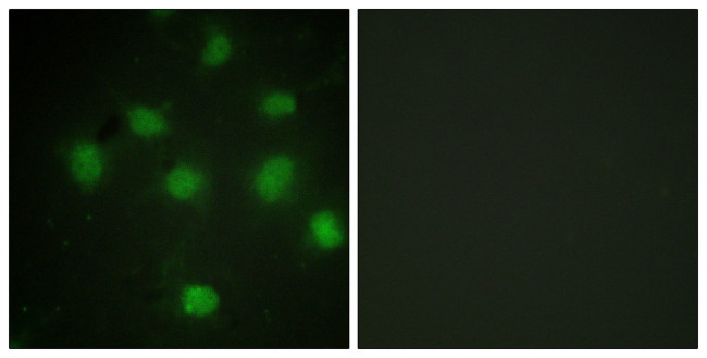 TLK1 Antibody in Immunocytochemistry (ICC/IF)