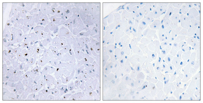 Phospho-53BP1 (Ser6) Antibody in Immunohistochemistry (Paraffin) (IHC (P))