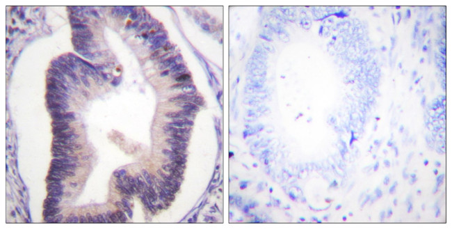 PFKFB2 Antibody in Immunohistochemistry (Paraffin) (IHC (P))