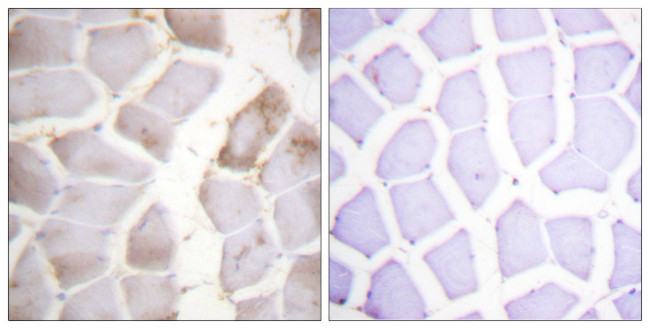 Phospho-AMPK beta-1 (Ser181) Antibody in Immunohistochemistry (Paraffin) (IHC (P))