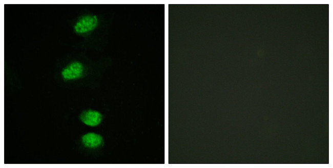 Phospho-Androgen Receptor (Ser94) Antibody in Immunocytochemistry (ICC/IF)