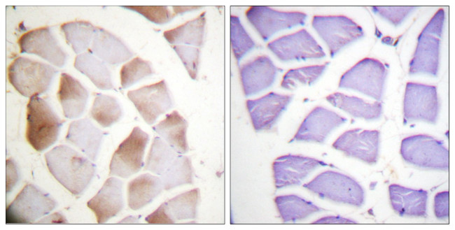 Phospho-ALOX5 (Ser271) Antibody in Immunohistochemistry (Paraffin) (IHC (P))