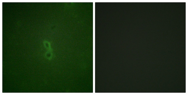 Phospho-Bcl-X (Thr47) Antibody in Immunocytochemistry (ICC/IF)