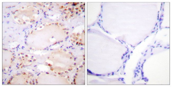 Phospho-ETK (Tyr566) Antibody in Immunohistochemistry (Paraffin) (IHC (P))