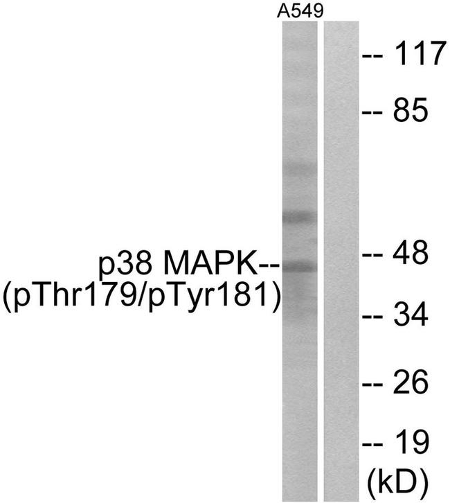Phospho-p38 MAPK (Thr179, Tyr181) Antibody in Western Blot (WB)