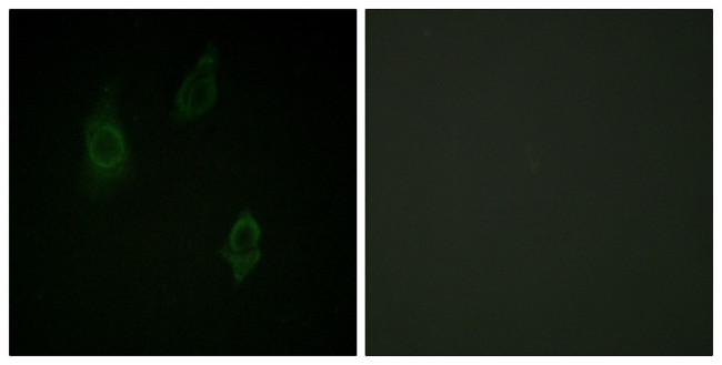 Phospho-PKC Pan (Thr497) Antibody in Immunocytochemistry (ICC/IF)