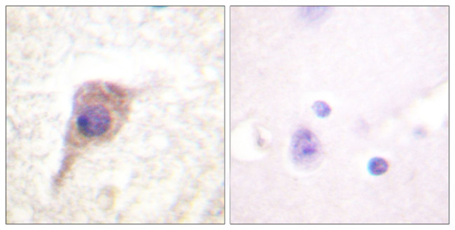 Phospho-PKC zeta (Thr560) Antibody in Immunohistochemistry (Paraffin) (IHC (P))