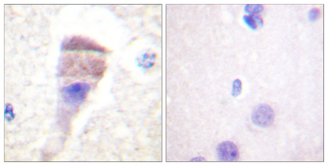 Phospho-PKC mu (Ser205) Antibody in Immunohistochemistry (Paraffin) (IHC (P))