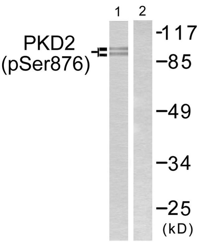 Phospho-PRKD2 (Ser876) Antibody in Western Blot (WB)