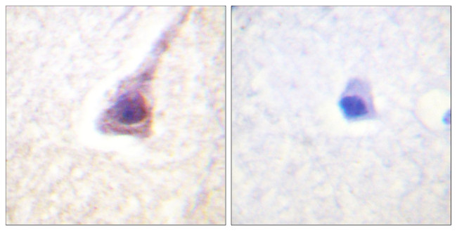 Phospho-PTP1B (Ser50) Antibody in Immunohistochemistry (Paraffin) (IHC (P))