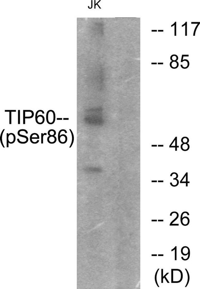 Phospho-TIP60 (Ser86) Antibody in Western Blot (WB)