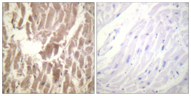 Phospho-Cardiac Troponin I (Ser43) Antibody in Immunohistochemistry (Paraffin) (IHC (P))