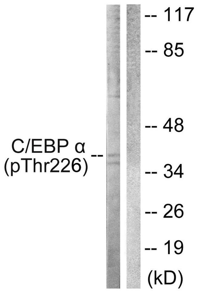 Phospho-C/EBP alpha (Thr226) Antibody in Western Blot (WB)