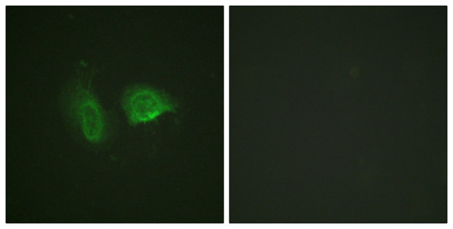 Phospho-Calcium Sensing Receptor (Thr888) Antibody in Immunocytochemistry (ICC/IF)