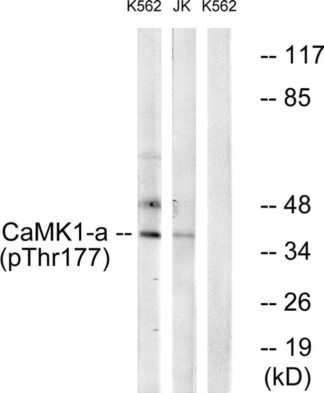 Phospho-CaMKI (Thr177) Antibody in Western Blot (WB)