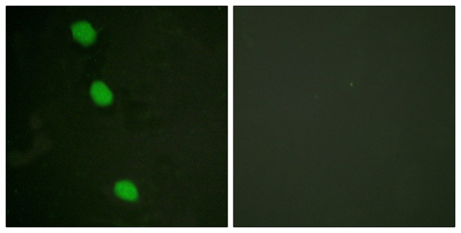 Phospho-CaMKIV (Thr196, Thr200) Antibody in Immunocytochemistry (ICC/IF)