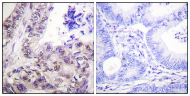 Phospho-Caspase 9 (Ser144) Antibody in Immunohistochemistry (Paraffin) (IHC (P))