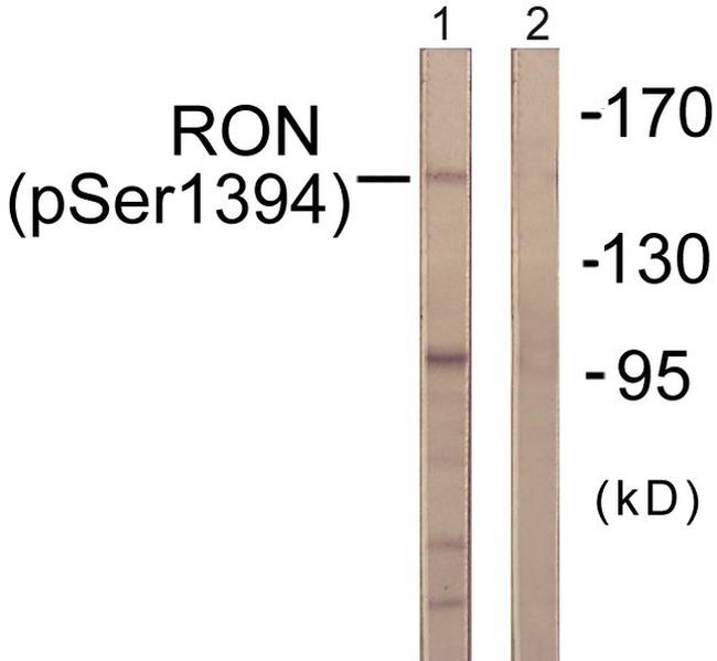 Phospho-RON (Ser1394) Antibody in Western Blot (WB)