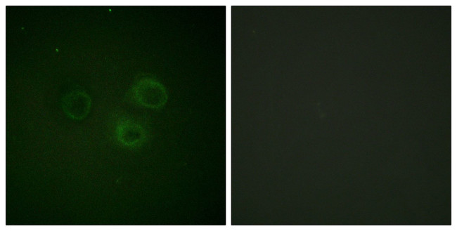Phospho-CD226 (Ser329) Antibody in Immunocytochemistry (ICC/IF)
