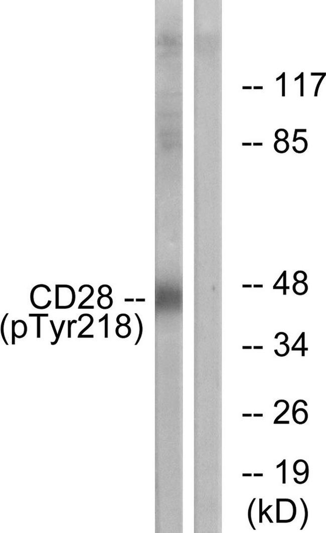 Phospho-CD28 (Tyr218) Antibody in Western Blot (WB)