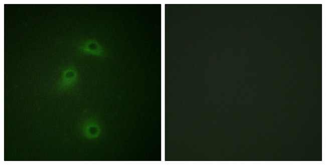 Phospho-DAPK2 (Ser318) Antibody in Immunocytochemistry (ICC/IF)