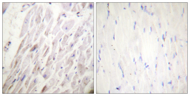 Phospho-Dematin (Ser403) Antibody in Immunohistochemistry (Paraffin) (IHC (P))