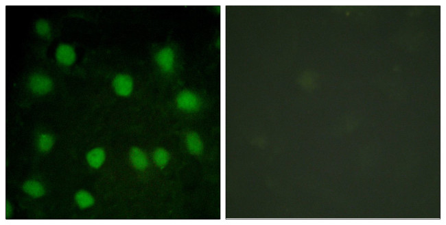 Dematin Antibody in Immunocytochemistry (ICC/IF)