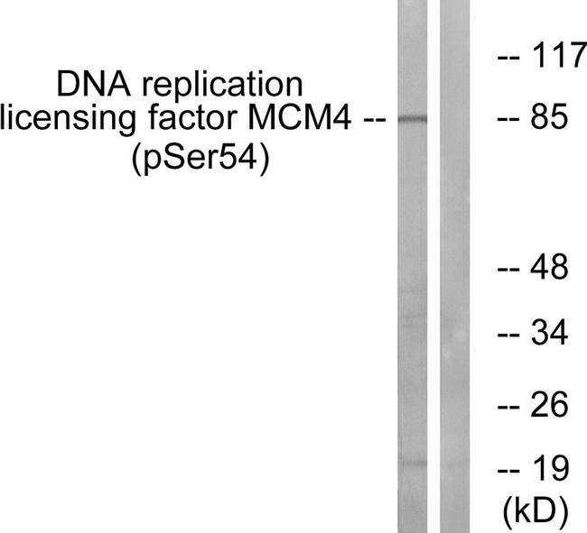 Phospho-MCM4 (Ser54) Antibody in Western Blot (WB)