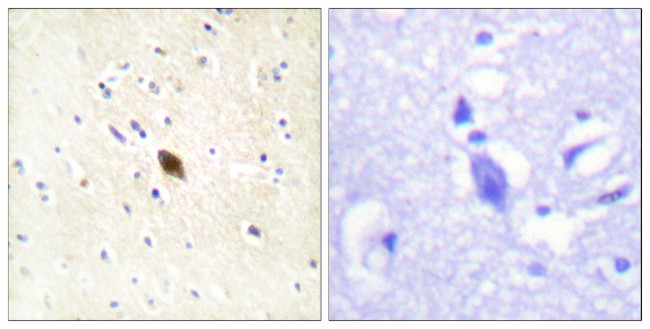 Phospho-DNA-PK (Ser2612) Antibody in Immunohistochemistry (Paraffin) (IHC (P))