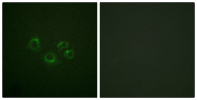 EphA2/EphA3/EphA4 Antibody in Immunocytochemistry (ICC/IF)