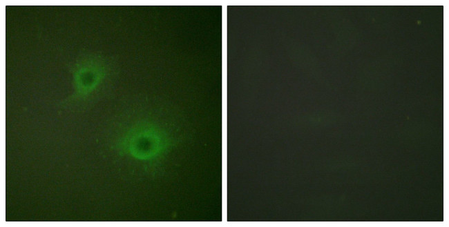 EphB1/EphB2 Antibody in Immunocytochemistry (ICC/IF)