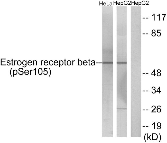 Phospho-Estrogen Receptor beta (Ser105) Antibody in Western Blot (WB)