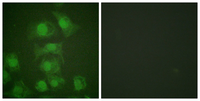 Phospho-FosB (Ser27) Antibody in Immunocytochemistry (ICC/IF)