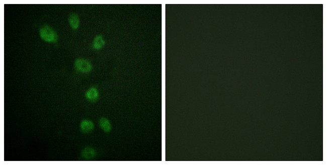 Phospho-GATA4 (Ser105) Antibody in Immunocytochemistry (ICC/IF)