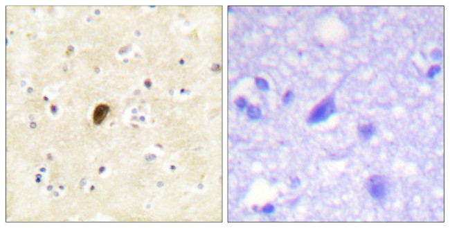 Phospho-GluR4 (Ser862) Antibody in Immunohistochemistry (Paraffin) (IHC (P))