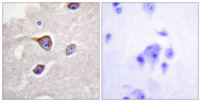 Phospho-GRK1 (Ser21) Antibody in Immunohistochemistry (Paraffin) (IHC (P))