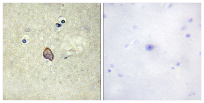 Phospho-ErbB3 (Tyr1328) Antibody in Immunohistochemistry (Paraffin) (IHC (P))