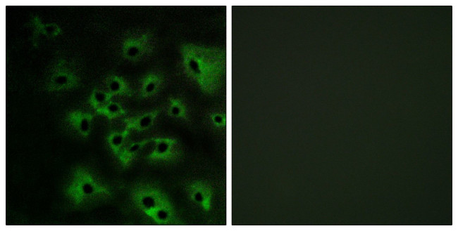 Phospho-ErbB4 (Tyr1284) Antibody in Immunocytochemistry (ICC/IF)