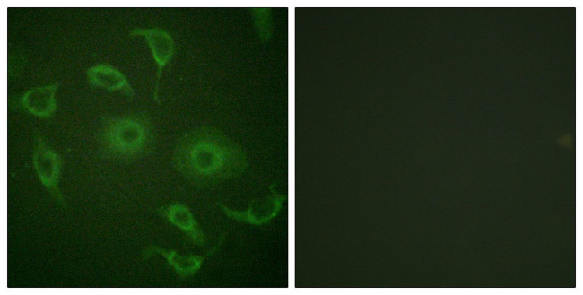 IFNAR1 Antibody in Immunocytochemistry (ICC/IF)