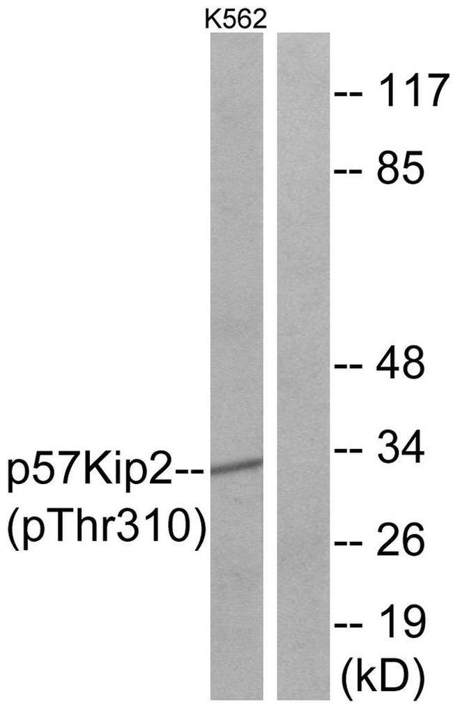 Phospho-p57 Kip2 (Thr310) Antibody in Western Blot (WB)
