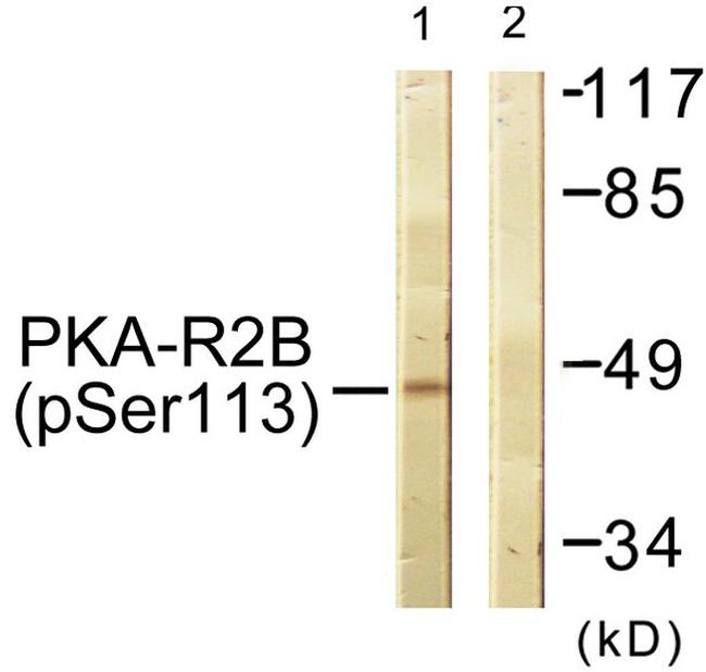Phospho-PRKAR2B (Ser113) Antibody in Western Blot (WB)