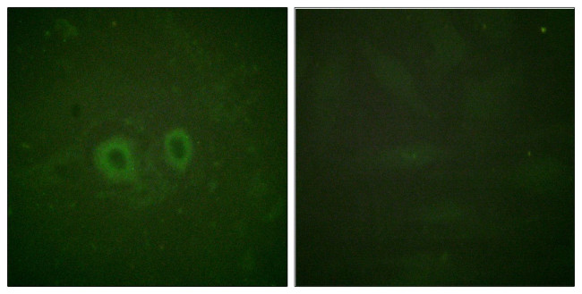 RET Antibody in Immunocytochemistry (ICC/IF)