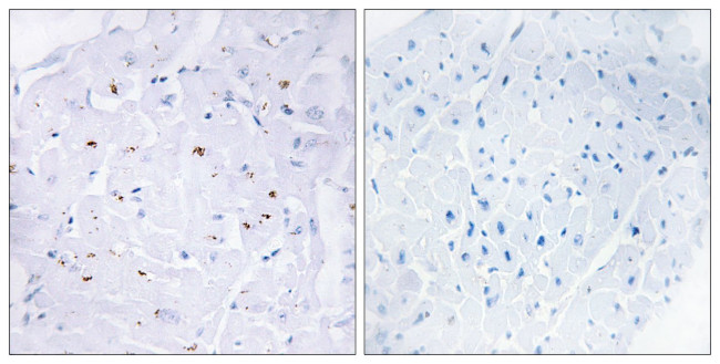 Phospho-SMAD3 (Thr179) Antibody in Immunohistochemistry (Paraffin) (IHC (P))