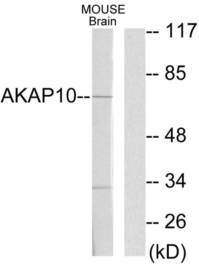AKAP10 Antibody in Western Blot (WB)