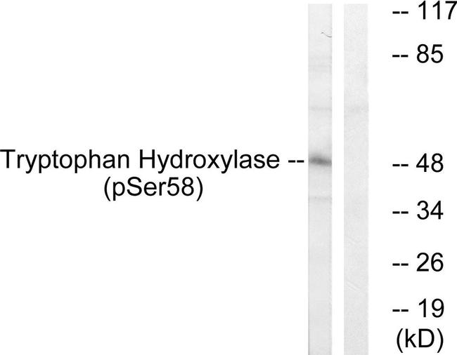 Phospho-TPH1 (Ser58) Antibody in Western Blot (WB)